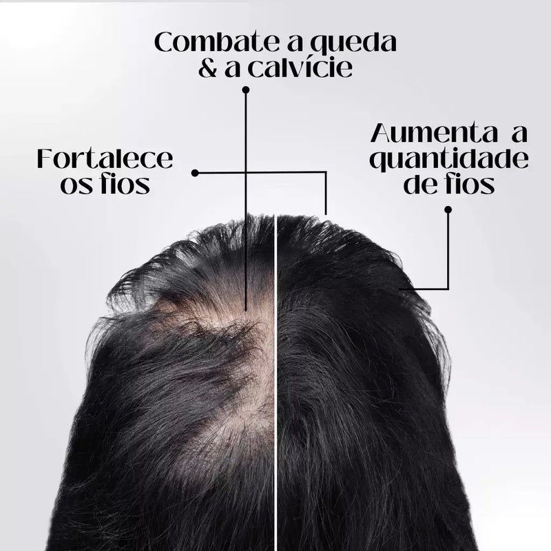 Tônico Capilar Repair Hair® | Crescimento Capilar e Combate à Queda de Cabelo